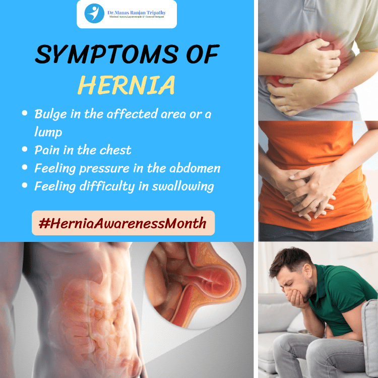 does-hernia-cause-stomach-pain-stomachguide